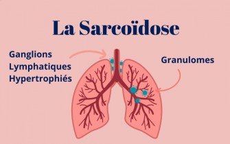 La sarco&iuml;dose