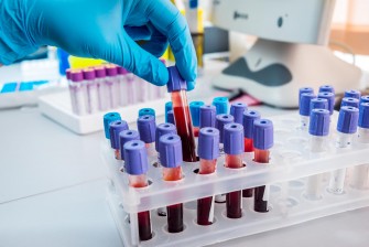 Un test sanguin détecte 8 types de cancers avant lapparition des symptômes