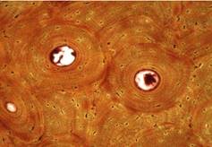 Structure lamellaire de l'os. Les lamelles sont organisées autour d'un canal.
